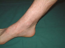 scar-accident-car Scar accident