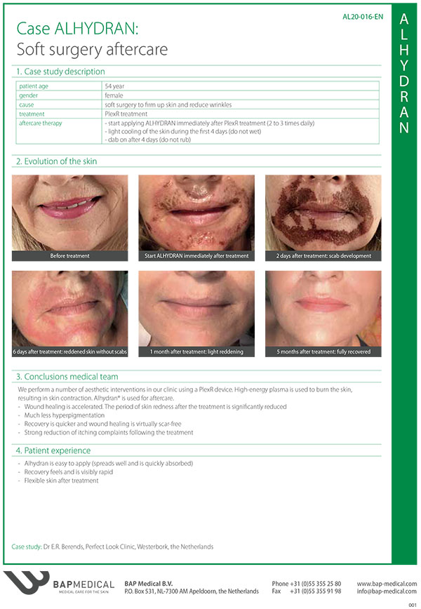 Case Study: Behandeling met ALHYDRAN na PlexR lasertherapie