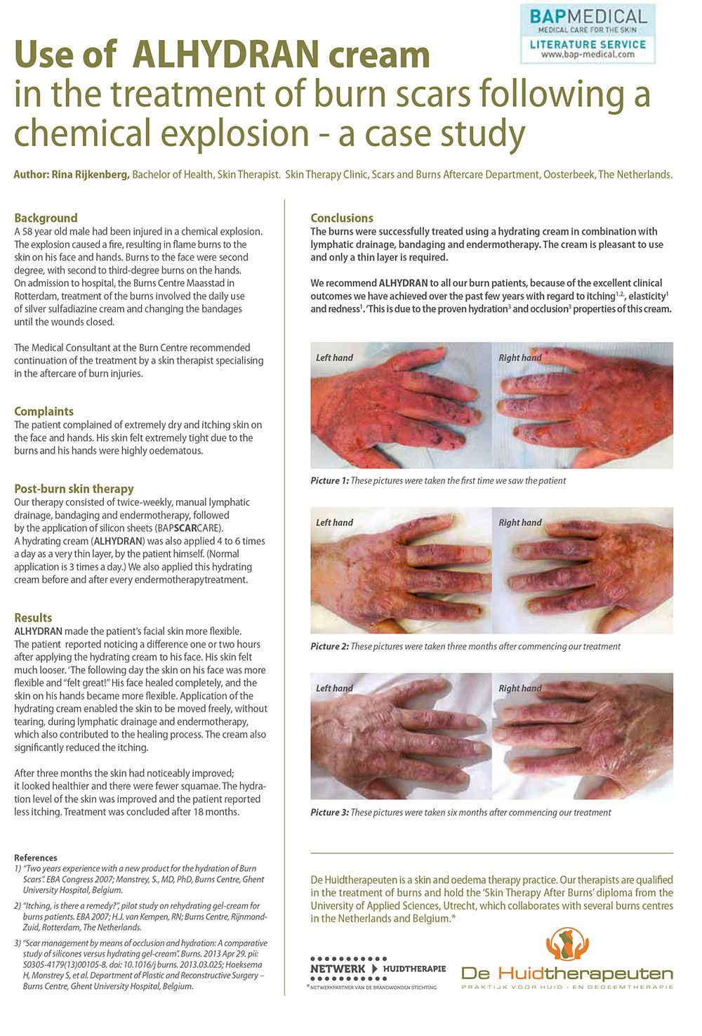 Bapscarcare clinical studies – Use_of_Alhydran_cream_in_the_treatment_of_burn_sca