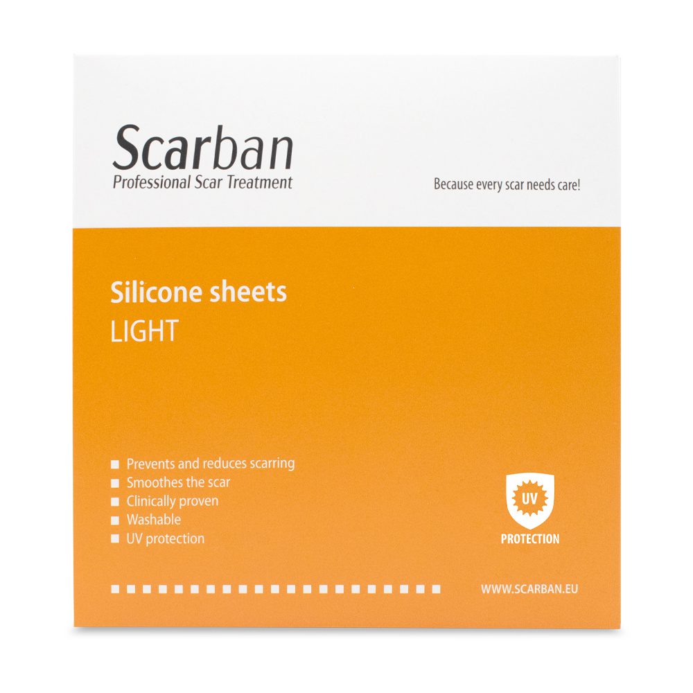 SB light