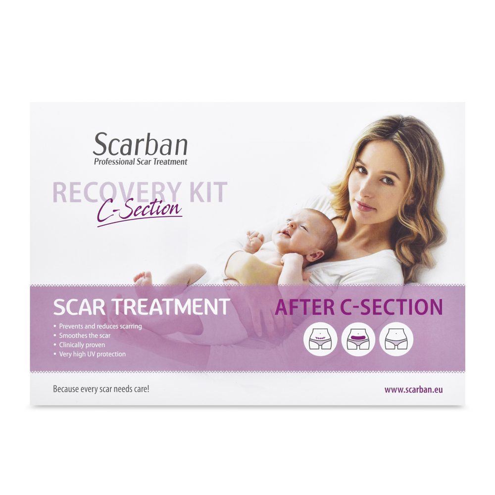 sb c-section kit