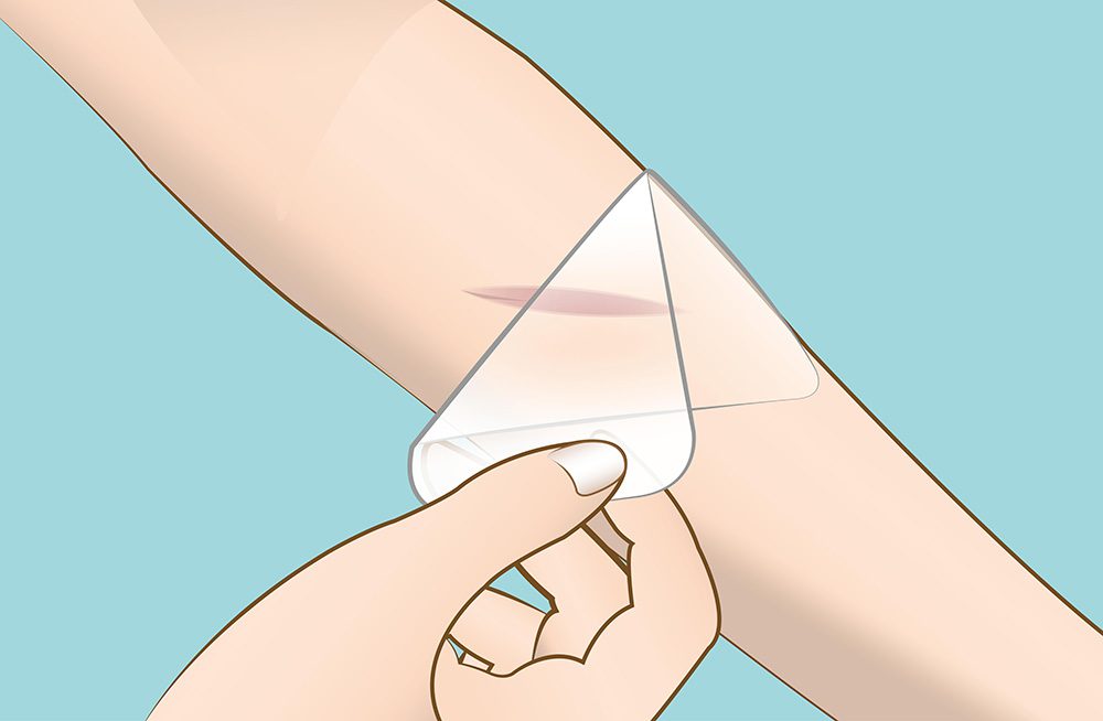 Bapscarcare Illustrations – Illustratie.sheet-arm