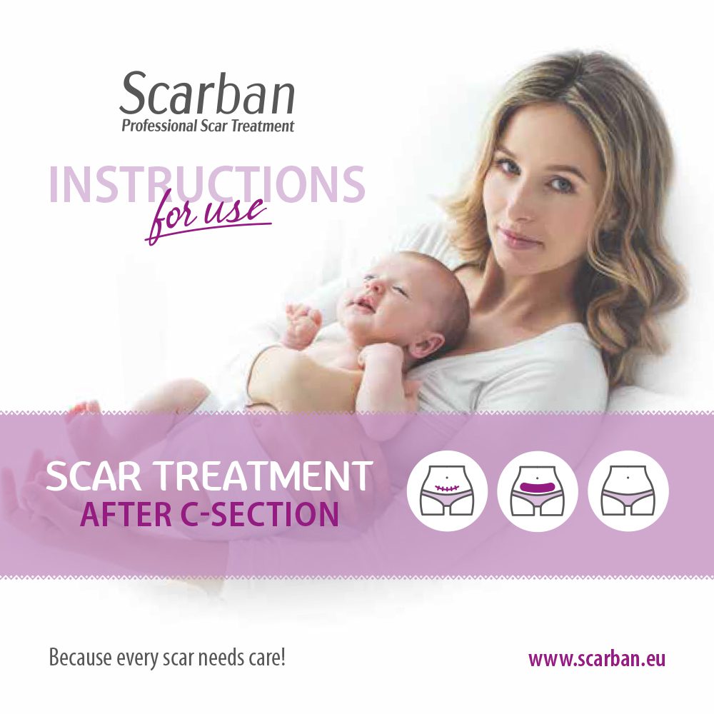 SB C-section IFU