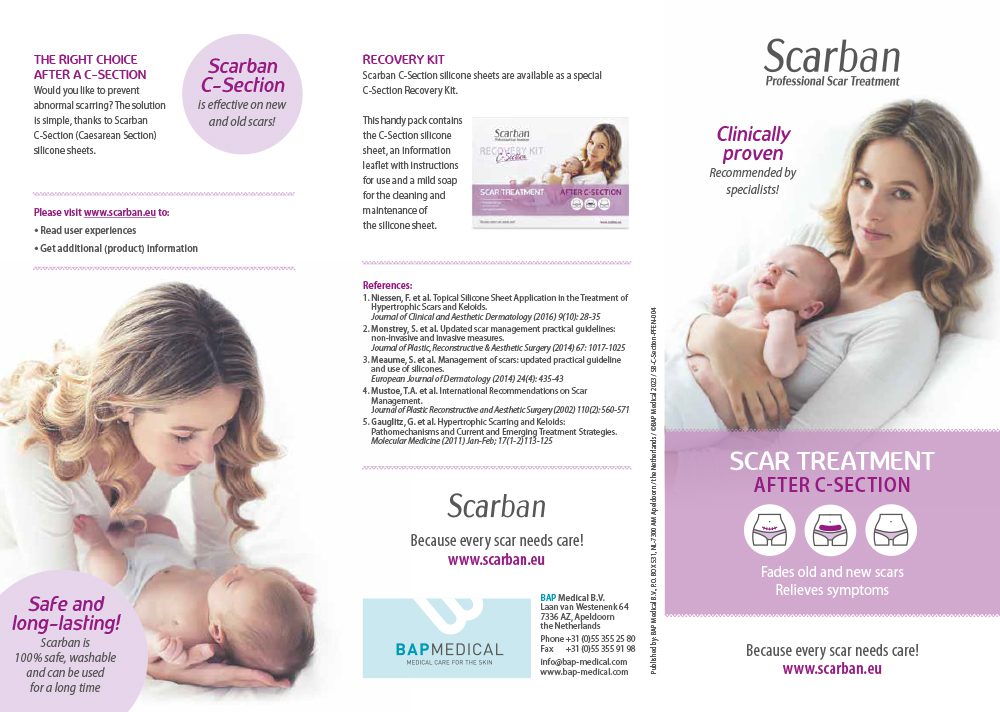 SB.C-section-PFEN-004