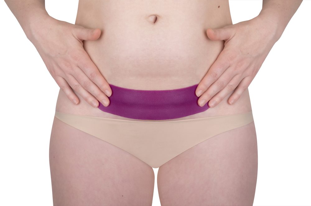 SB C-section.2