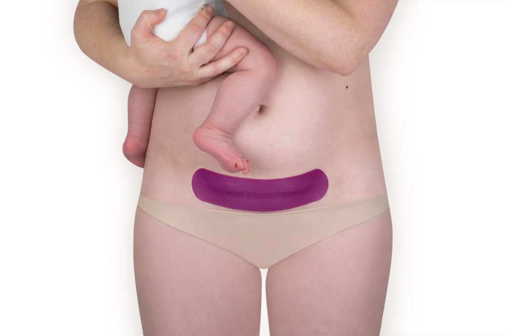 SB C-section.3.