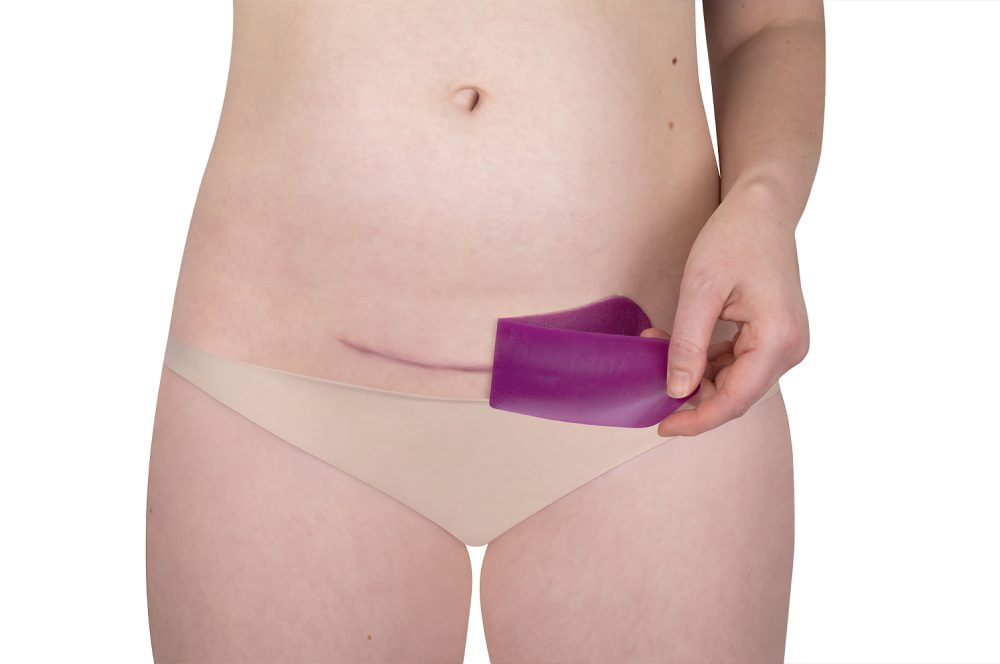 SB C-section.4