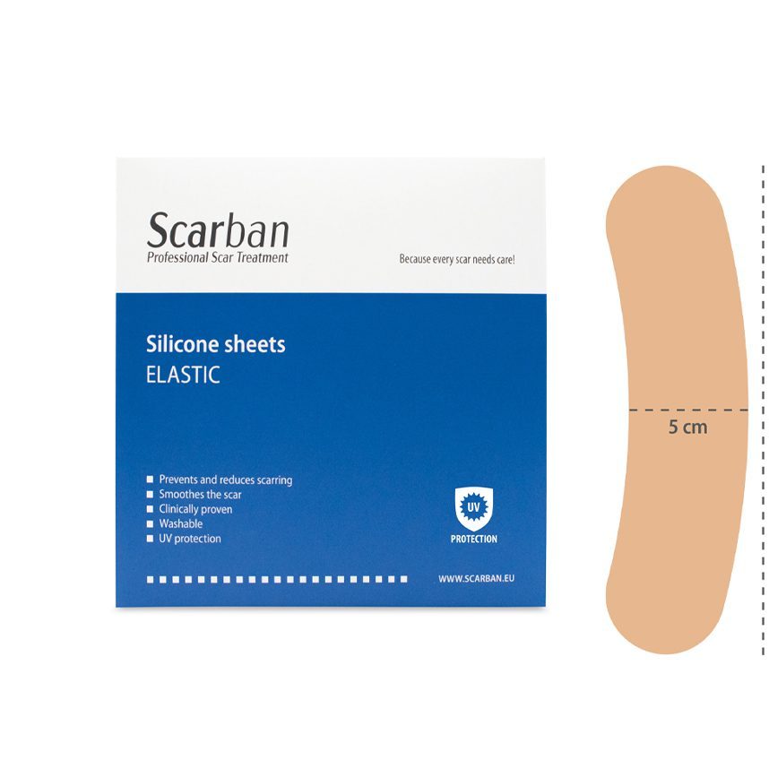 SB elastic.Hysterectomy