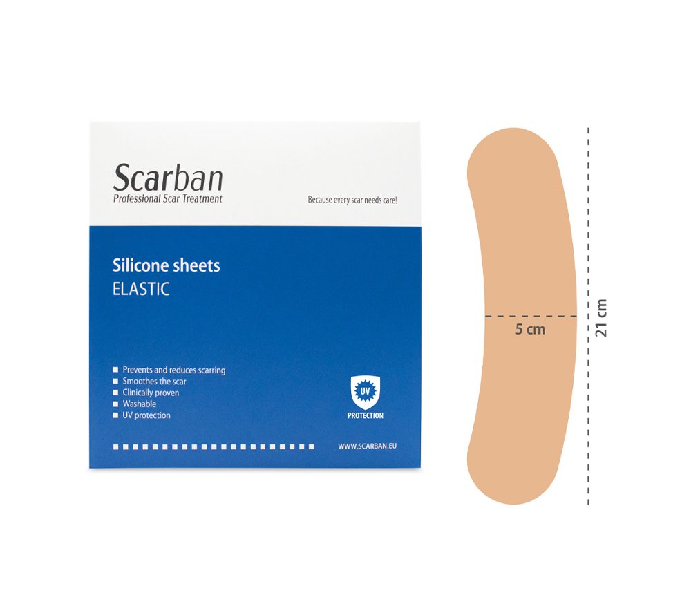 SB elastic.Hysterectomy