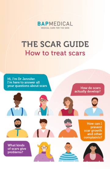 scar guide EN image small