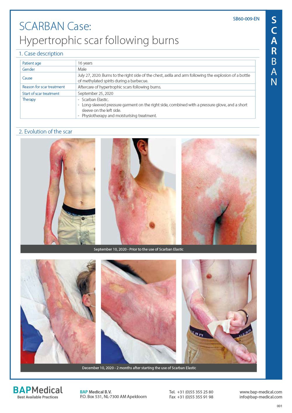 SB60.009.Case.Studies.001.EN.def